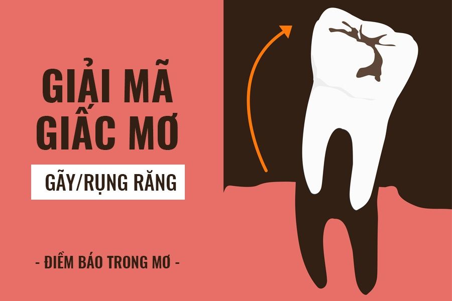 Nằm mơ thấy rụng răng đánh lô đề con gì - Khám Phá Ý Nghĩa và Dự Đoán